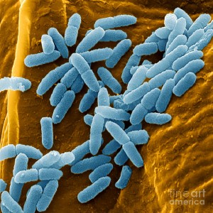 pseudomonas-aeruginosa-bacteria-sem-spl